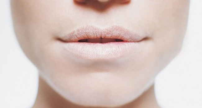 Почему сохнут губы?